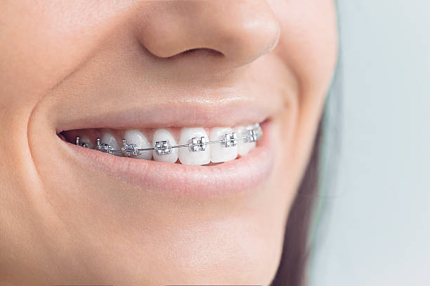 Best Veneers and Lumineers  in Little Cypress, TX